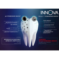 INNOVA SENSITIVE ЗУБНАЯ ПАСТА БЕРЕЖНОЕ ОСВЕТЛЕНИЕ ЭМАЛИ 75МЛ