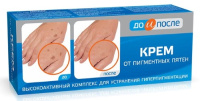 ДО И ПОСЛЕ КРЕМ ОТ ПИГМЕНТНЫХ ПЯТЕН 50МЛ